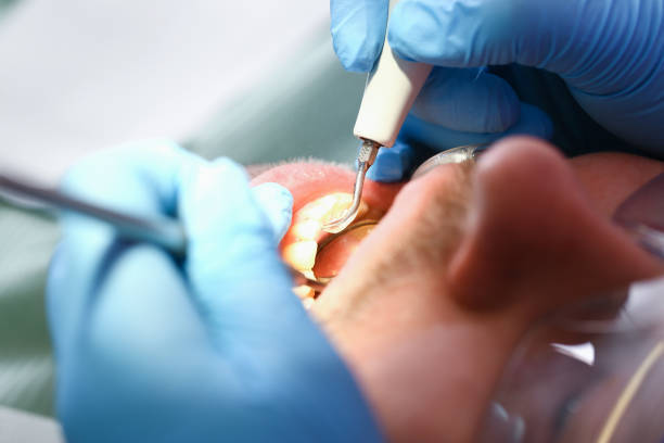 Best Emergency Denture Repair in Long Creek, IL
