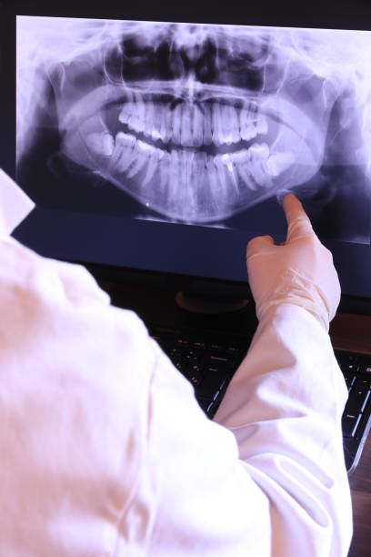 Best Emergency Dental Care for Broken or Chipped Teeth in Long Creek, IL