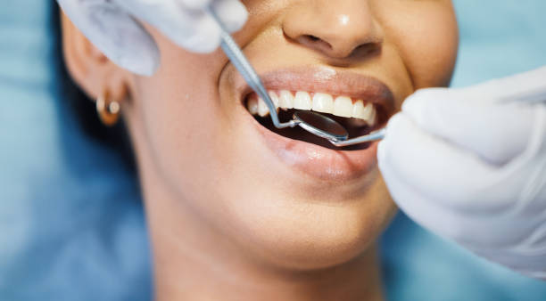 Best After-Hours Dental Trauma Care in Long Creek, IL