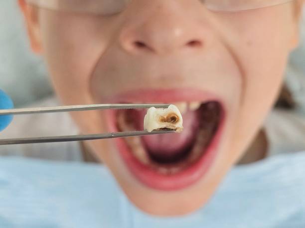 Best Emergency Denture Repair in Long Creek, IL